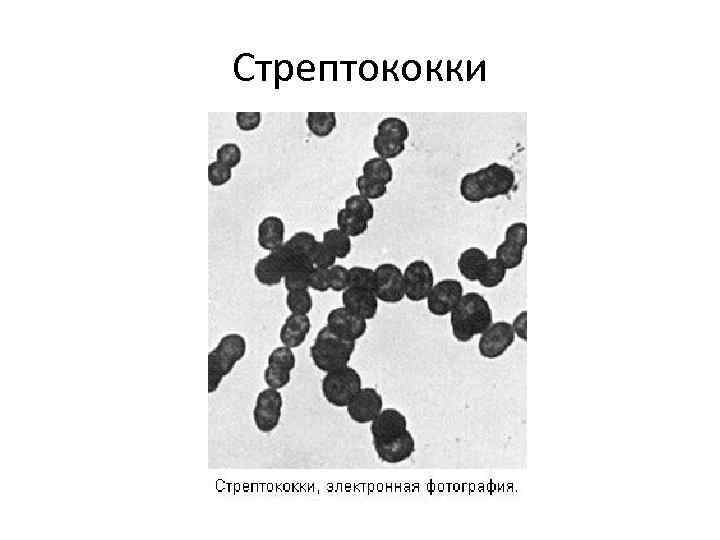 Стрептококки микробиология