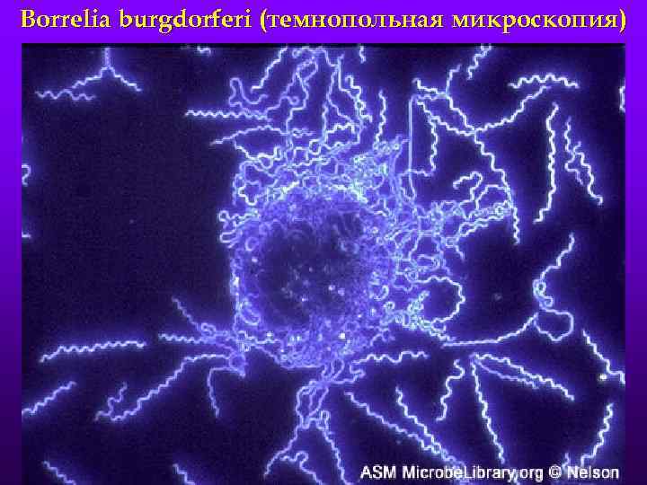 Borrelia burgdorferi (темнопольная микроскопия) 