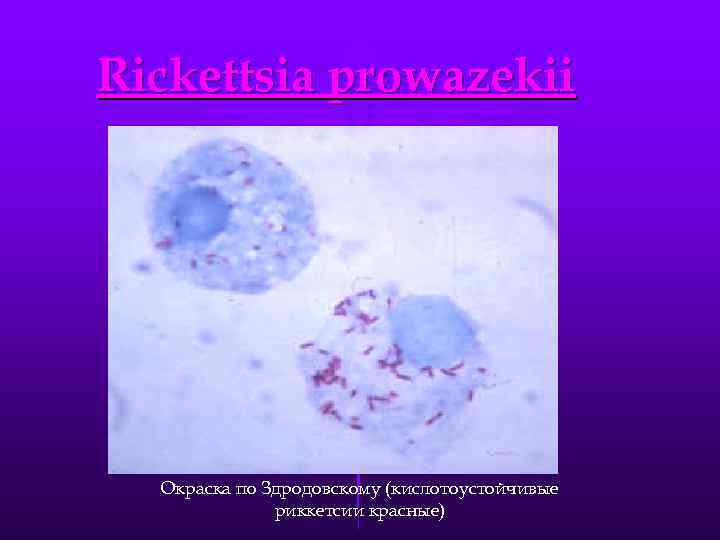 Rickettsia prowazekii