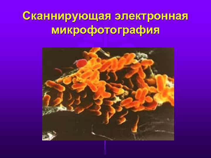 Сканнирующая электронная микрофотография 