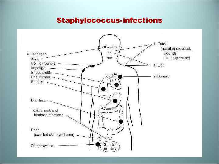Staphylococcus-infections 