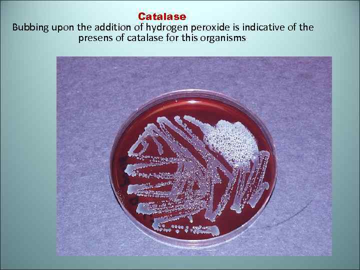  Catalase Bubbing upon the addition of hydrogen peroxide is indicative of the presens
