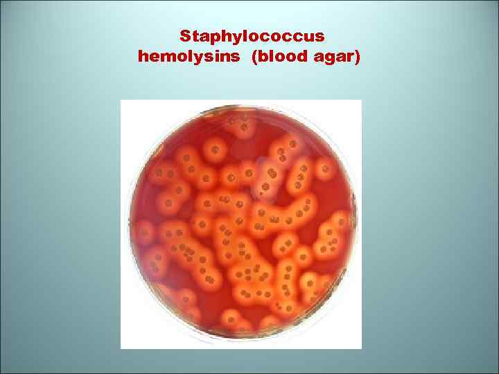 Staphylococcus hemolysins (blood agar) 