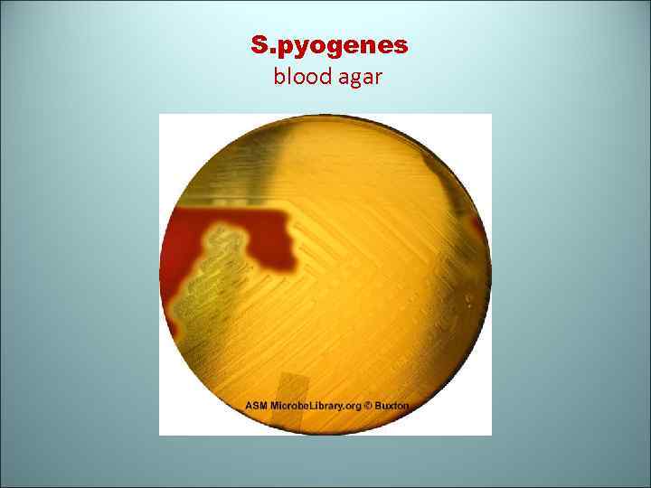 S. pyogenes blood agar 
