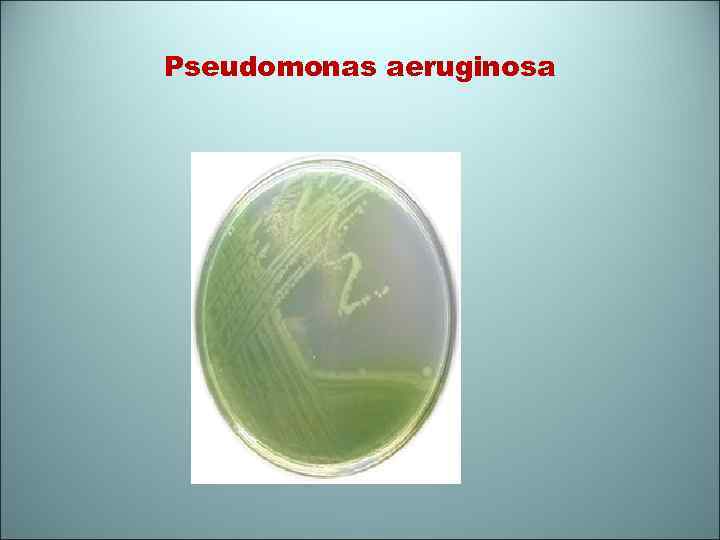 Pseudomonas aeruginosa 