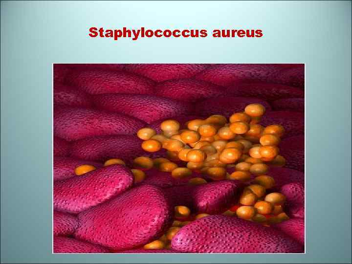 Staphylococcus aureus 