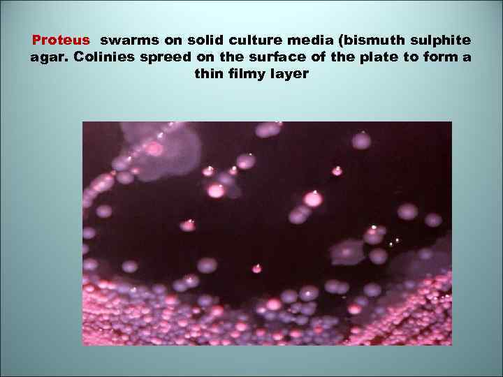 Proteus swarms on solid culture media (bismuth sulphite agar. Colinies spreed on the surface