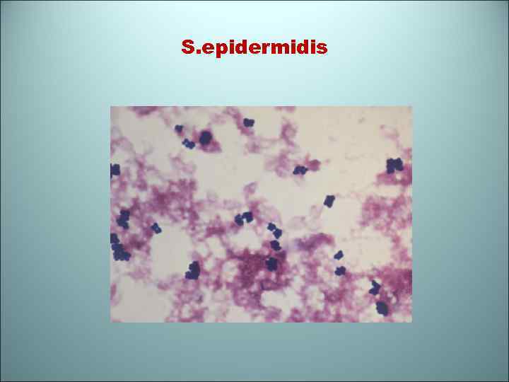 S. epidermidis 