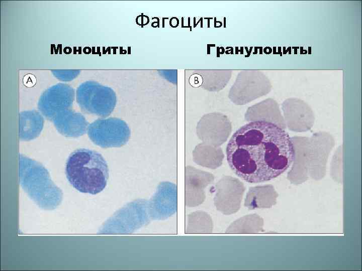 Фагоциты Моноциты Гранулоциты 