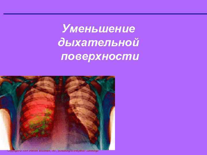 Уменьшение дыхательной поверхности Copyright © 2004 Pearson Education, Inc. , publishing as Benjamin Cummings
