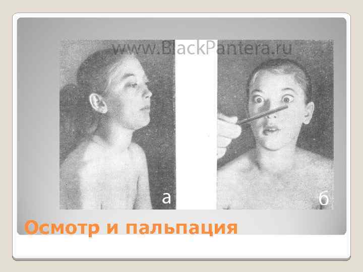 Осмотр и пальпация 