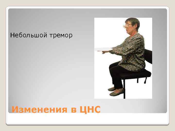  Небольшой тремор Изменения в ЦНС 