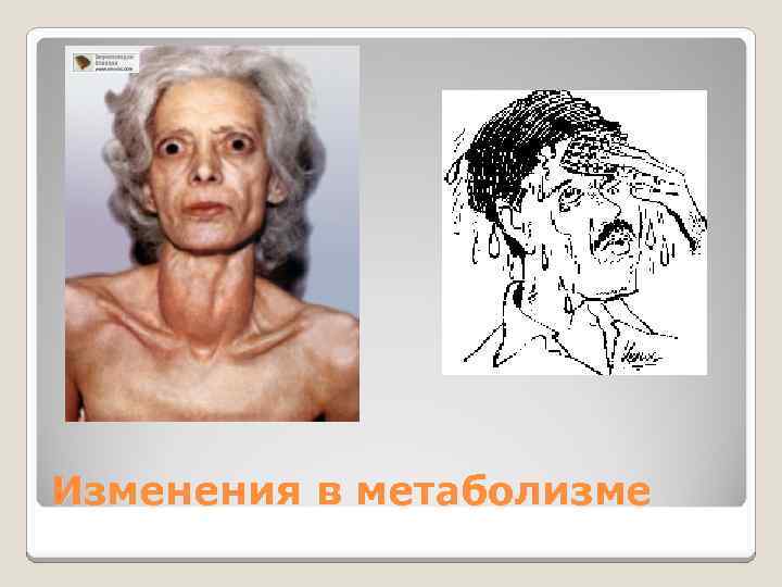 Изменения в метаболизме 