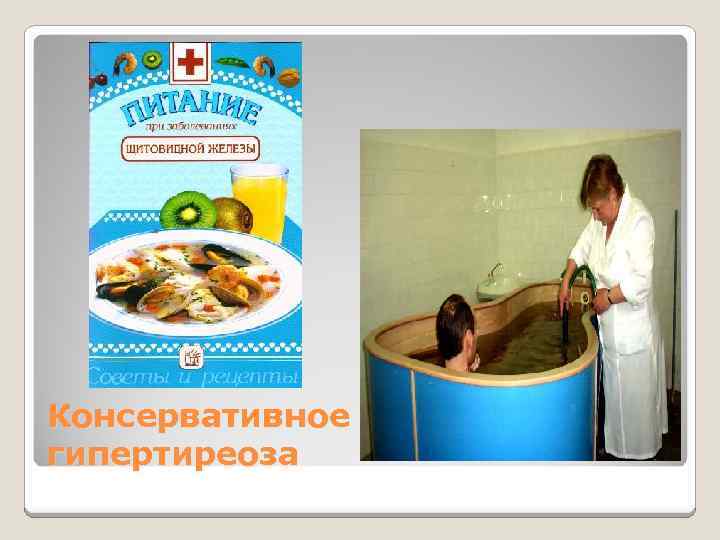 Консервативное лечение гипертиреоза 