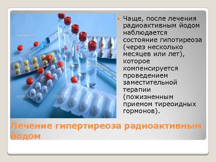  Чаще, после лечения радиоактивным йодом наблюдается состояние гипотиреоза (через несколько месяцев или лет),