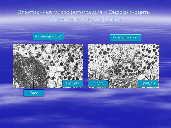 Электронная микрофотография « Эндокриноциты панкреатического островка» . А - эндокриноцит В - эндокриноцит Гранулы