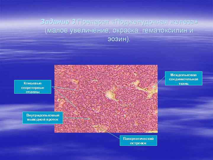 Задание 3. Препарат «Поджелудочная железа» (малое увеличение, окраска: гематоксилин и эозин). Междольковая соединительная ткань