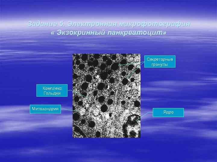 Задание 5. Электронная микрофотография « Экзокринный панкреатоцит» Секреторные гранулы Комплекс Гольджи Митохондрия Ядро 