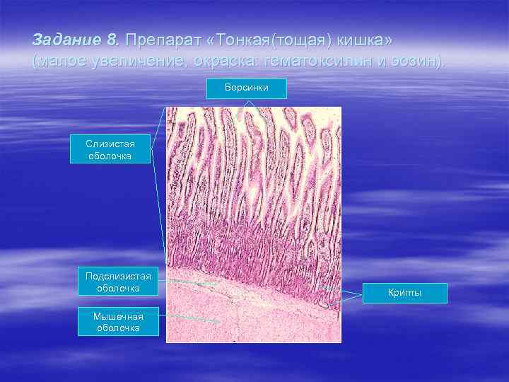 Задание 8. Препарат «Тонкая(тощая) кишка» (малое увеличение, окраска: гематоксилин и эозин). Ворсинки Слизистая оболочка
