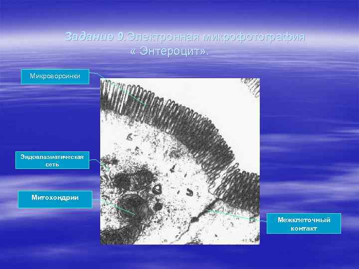 Задание 9. Электронная микрофотография « Энтероцит» . Микроворсинки Эндоплазматическая сеть Митохондрии Межклеточный контакт 