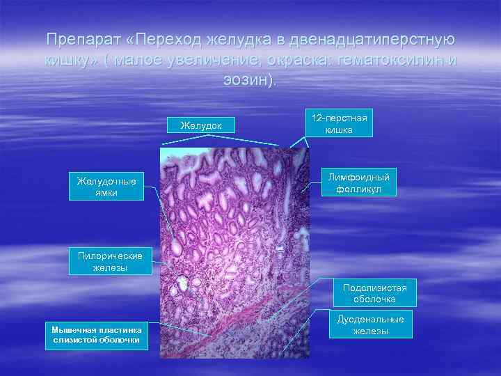 Препарат «Переход желудка в двенадцатиперстную кишку» ( малое увеличение, окраска: гематоксилин и эозин). Желудок