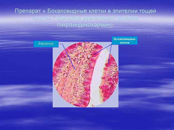 Препарат « Бокаловидные клетки в эпителии тощей кишки» ( большое увеличение, окраска: пикроиндикокармин). Ворсинка