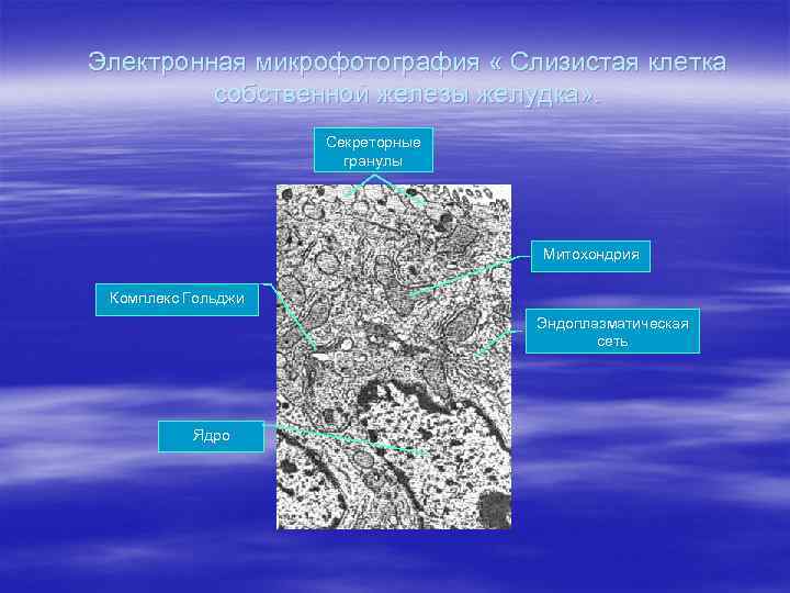 Электронная микрофотография « Слизистая клетка собственной железы желудка» . Секреторные гранулы Митохондрия Комплекс Гольджи