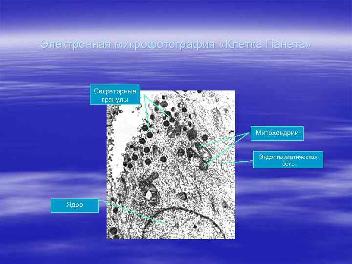 Электронная микрофотография «Клетка Панета» Секреторные гранулы Митохондрии Эндоплазматическая сеть Ядро 