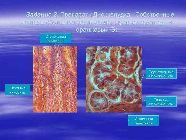 Задание 2. Препарат «Дно желудка. Собственные железы» (большое увеличение, окраска: гемалаун и оранжевый G).