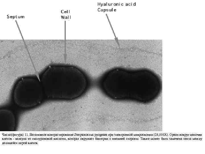 Число(фигура) 11. Негативное контрастирование Streptococcus pyogenes при электронной микроскопии (28, 000 X). Ореол вокруг