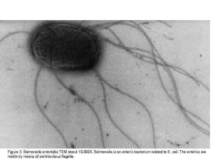 Figure 3. Salmonella enteritidis TEM about 10, 000 X. Salmonella is an enteric bacterium