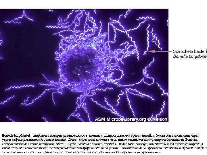 Borrelia burgdorferi - спирохеты, которые размножаются в, клещах и распространяются среди мышей, и белохвостыми