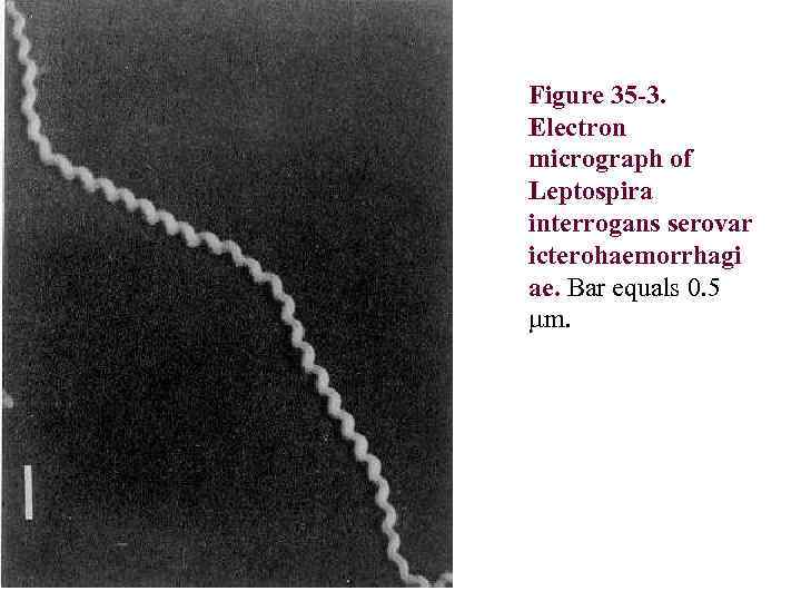 Figure 35 -3. Electron micrograph of Leptospira interrogans serovar icterohaemorrhagi ae. Bar equals 0.