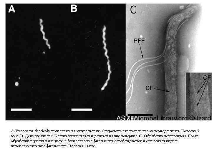 А. Treponema denticola темнопольная микроскопия. Спирохеты ответственные за периодонтиты. Полоска 5 мкм. В. Деление