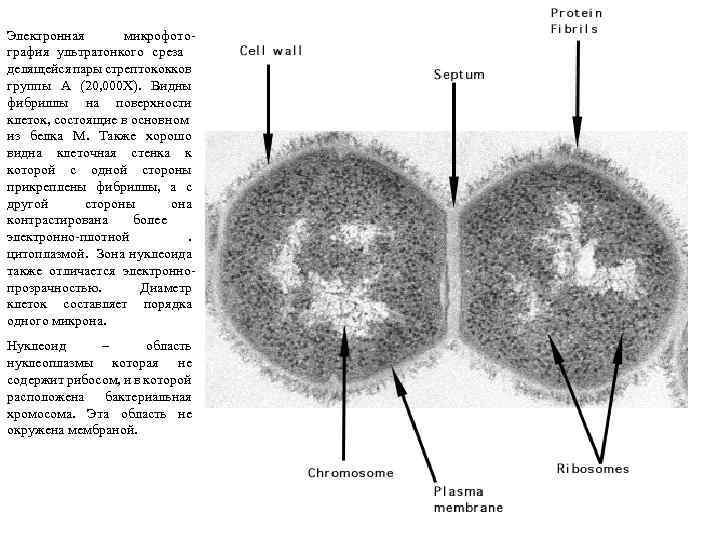 Электронная микрофотография ультратонкого среза делящейся пары стрептококков группы А (20, 000 X). Видны фибриллы
