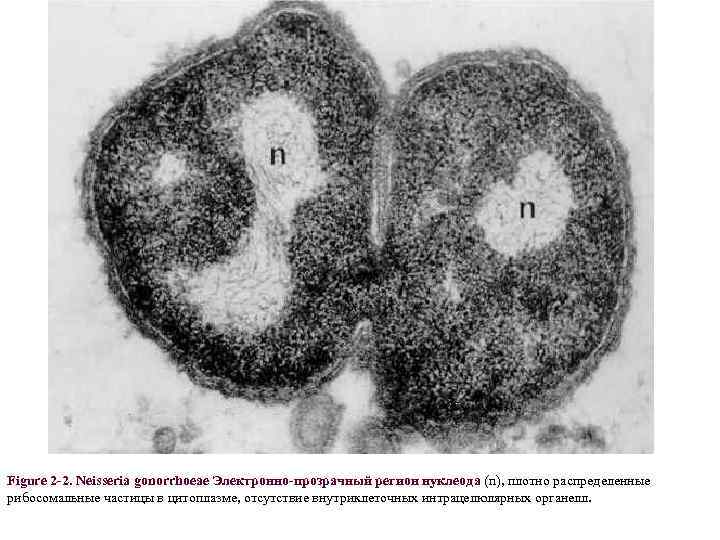 Figure 2 -2. Neisseria gonorrhoeae Электронно-прозрачный регион нуклеода (n), плотно распределенные рибосомальные частицы в