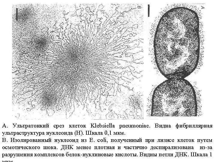 А. Ультратонкий срез клеток Klebsiella pneumoniae. Видна фибриллярная ультраструктура нуклеоида (Н). Шкала 0, 1