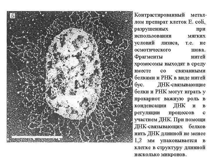 Контрастированный металлом препарат клеток E. coli, разрушенных при использовании мягких условий лизиса, т. е.