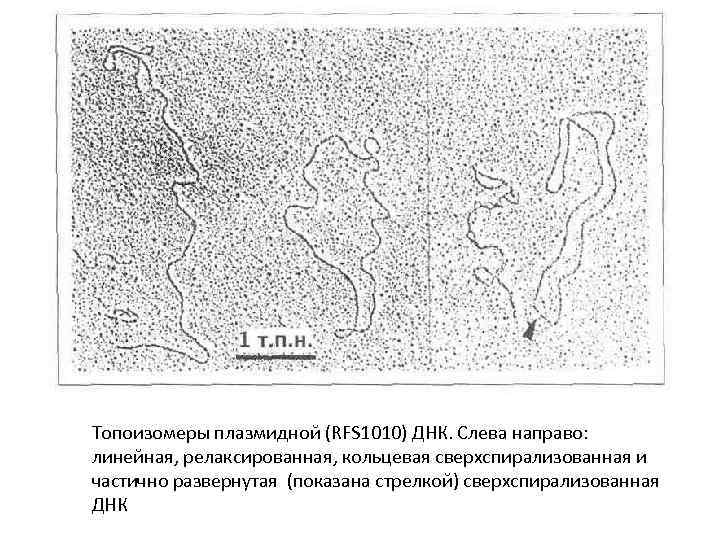 Топоизомеры плазмидной (RFS 1010) ДНК. Слева направо: линейная, релаксированная, кольцевая сверхспирализованная и частично развернутая