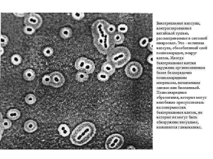 Бактериальные капсулы, контрастированные китайской тушью, рассматриваемые в световой микроскоп. Это - истинная капсула, обособленный
