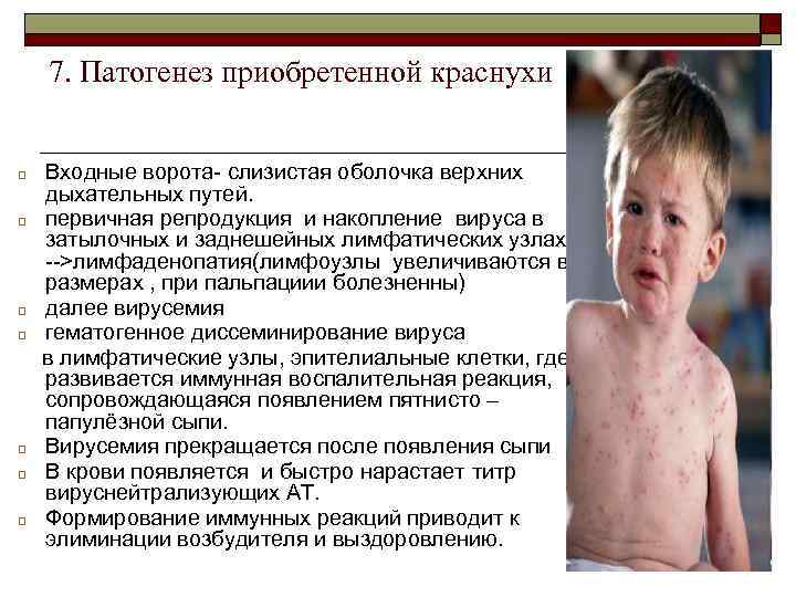 7. Патогенез приобретенной краснухи q q q q Входные ворота- слизистая оболочка верхних дыхательных