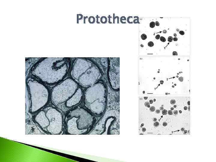 Prototheca 