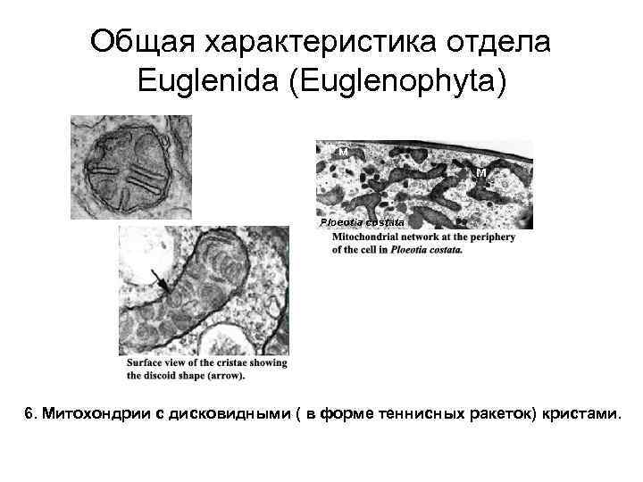 Общая характеристика отдела Euglenida (Euglenophyta) 6. Митохондрии с дисковидными ( в форме теннисных ракеток)