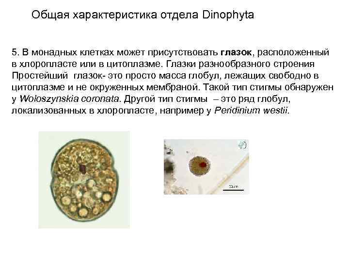 Общая характеристика отдела Dinophyta 5. В монадных клетках может присутствовать глазок, расположенный в хлоропласте