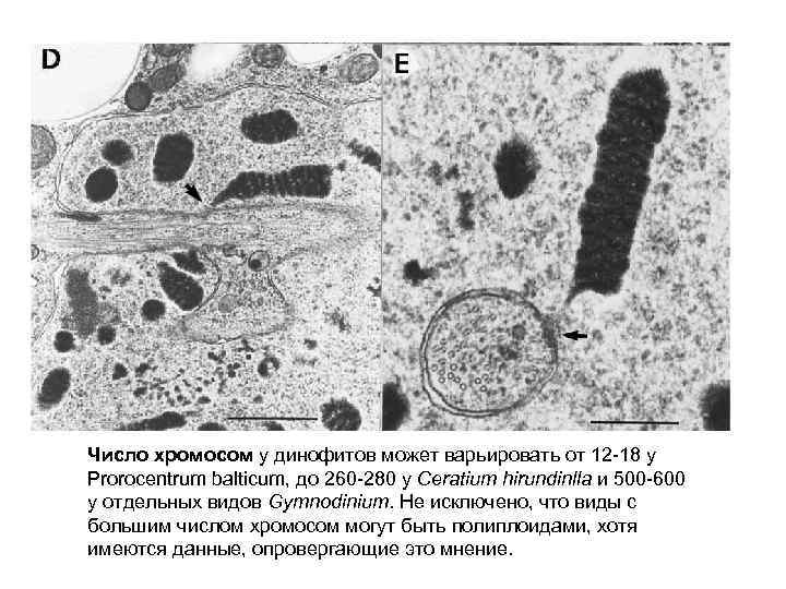 Число хромосом у динофитов может варьировать от 12 -18 у Prorocentrum balticum, до 260