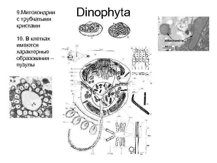 9. Митохондрии с трубчатыми кристами 10. В клетках имеются характерные образования – пузулы Dinophyta