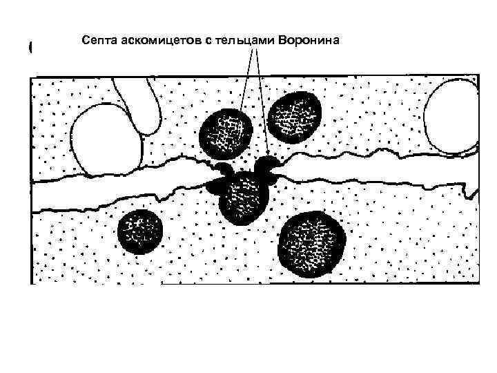 Септа аскомицетов с тельцами Воронина 