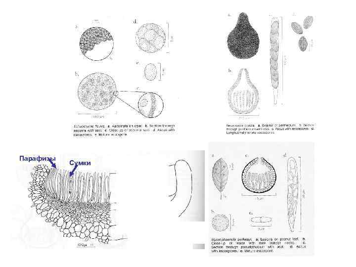 Парафизы Сумки 