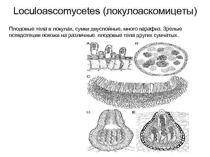 Loculoascomycetes (локулоаскомицеты) Плодовые тела в локулах, сумки двуслойные, много парафиз. Зрелые псевдотеции похожи на