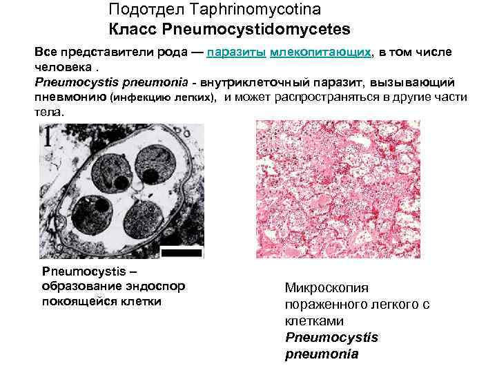 Подотдел Taphrinomycotina Класс Pneumocystidomycetes Все представители рода — паразиты млекопитающих, в том числе человека.
